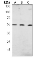 PPAR alpha Mouse Monoclonal Antibody(C3880)