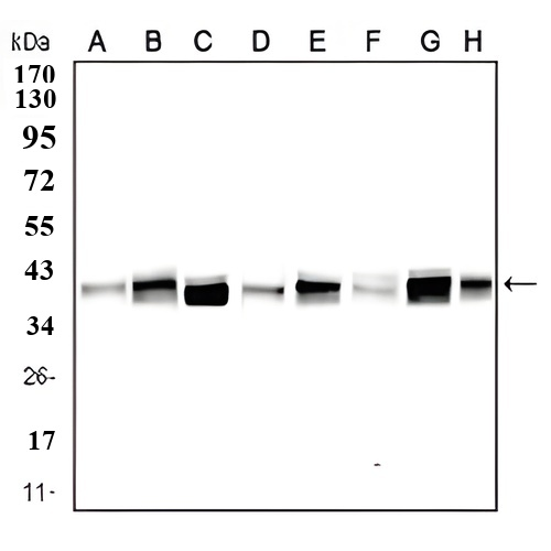 TRBC1 Mouse Monoclonal Antibody(ARA662)