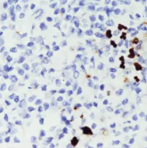 CMV Mouse Monoclonal Antibody(8B1.2, 1G5.2 & 2D4.2)