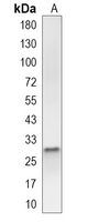 G-CSF Rabbit Monoclonal Antibody(C4068)