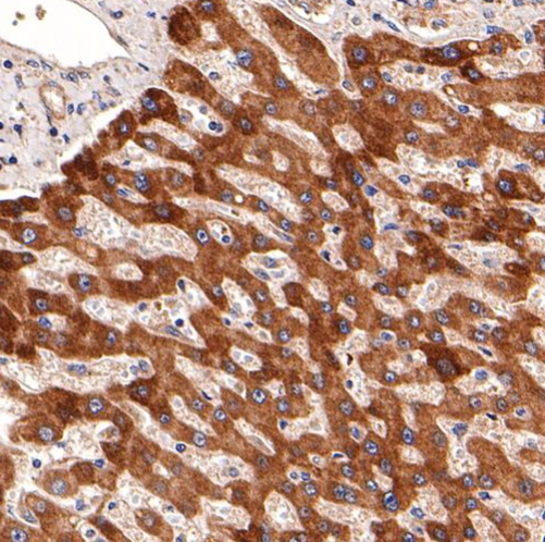 Adipophilin Rabbit Monoclonal Antibody(ARA657)