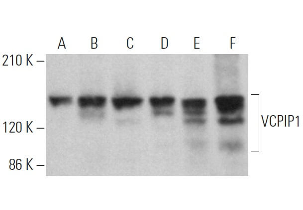 VCPIP1 Mouse Monoclonal Antibody(ARA658)
