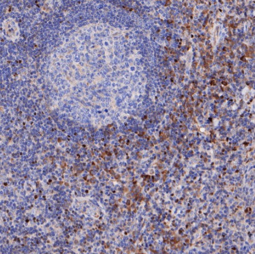 Fos-B Rabbit Monoclonal Antibody(ARA656)