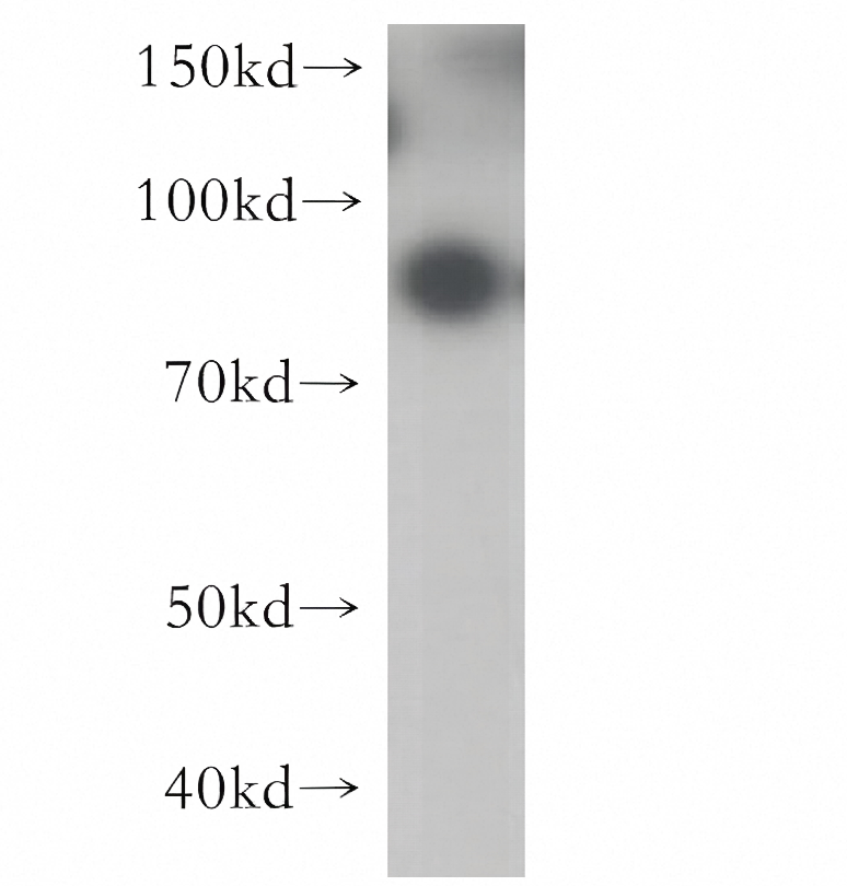 G-CSFR Rabbit Polyclonal Antibody