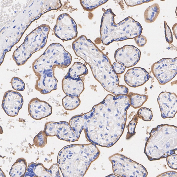 Thrombomodulin Rabbit Monoclonal Antibody(ARA646)