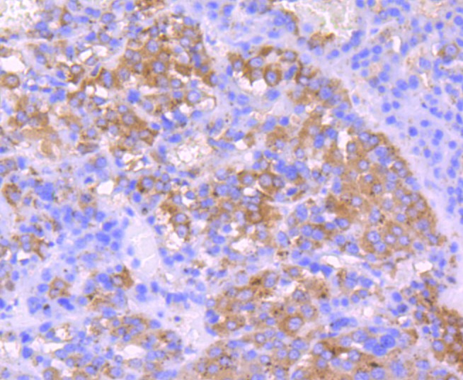 IGF2 Rabbit Monoclonal Antibody(ARA655)