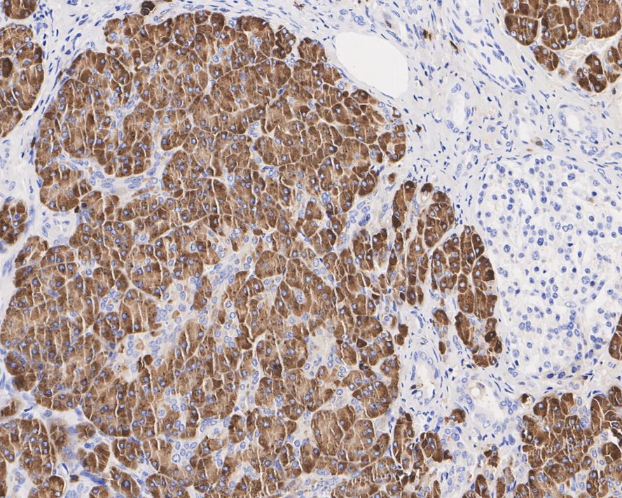 CPA1/Carboxypeptidase 1 Rabbit Monoclonal Antibody(ARA649)