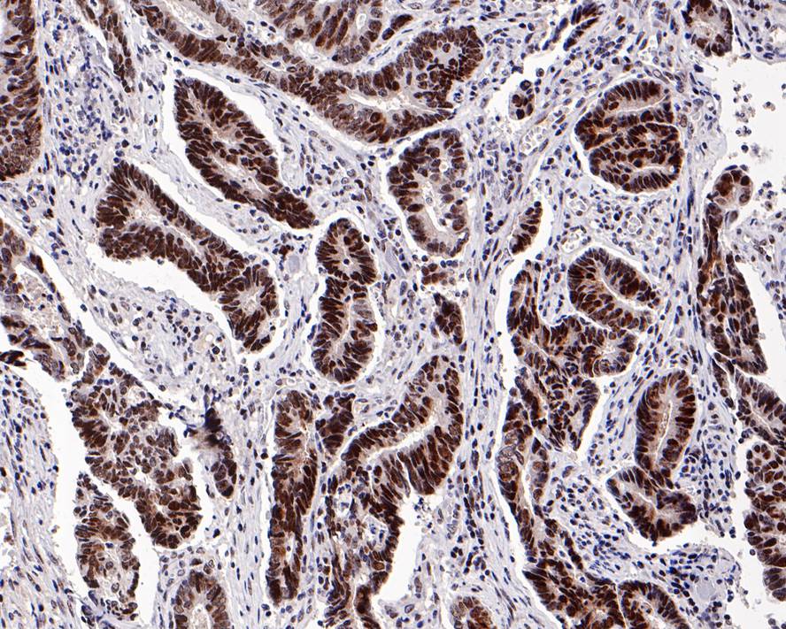 NPM1/Nucleophosmin Rabbit Monoclonal Antibody(ARA648)