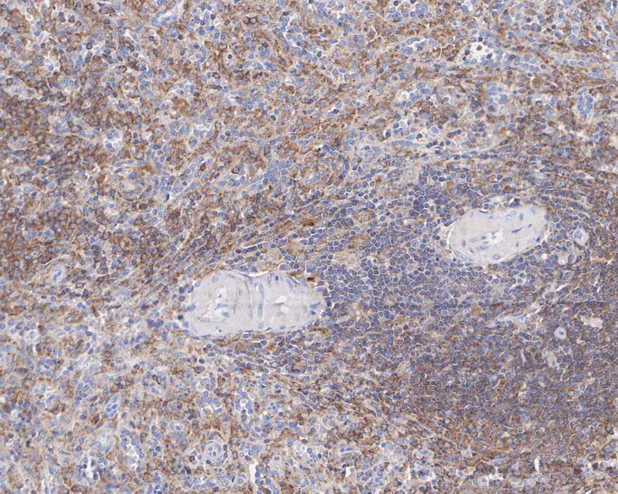 Prkcb Rabbit Monoclonal Antibody(ARA650)