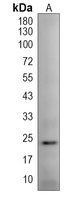 REEP6 Rabbit Polyclonal Antibody