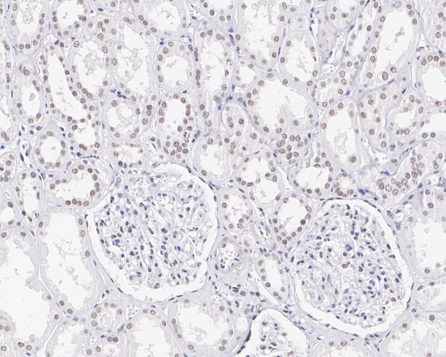 Parafibromin/CDC73 Rabbit Monoclonal Antibody(ARA645)