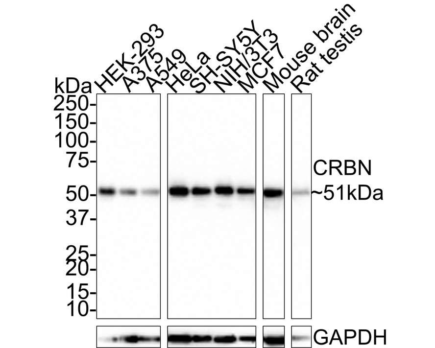 CRBN Rabbit Monoclonal Antibody(ARA644)