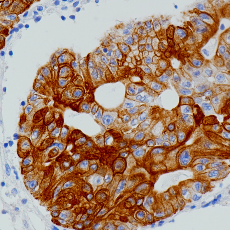 Cytokeratin 20 Rabbit Monoclonal Antibody(ARB938)