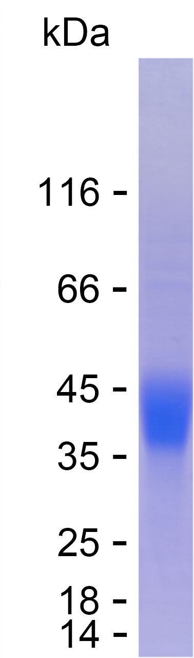 Recombinant Human CD74 Protein