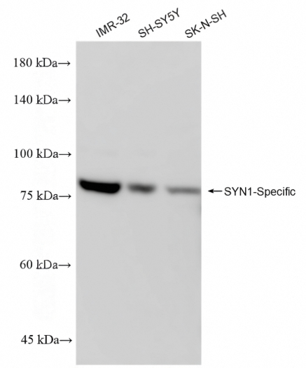 SYN1-Specific Rabbit Monoclonal Antibody(ARA630)